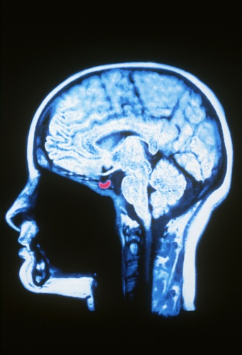 Neurosurgery & Spine Surgery Center