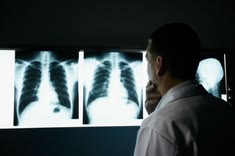 Interventional Pulmonology & Respiratory ICU